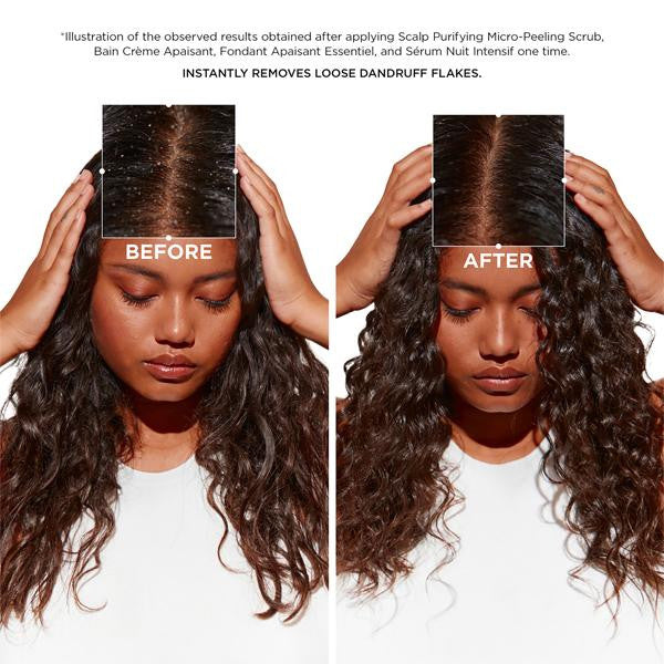 Micro-Peeling Cellulaire 6.8oz