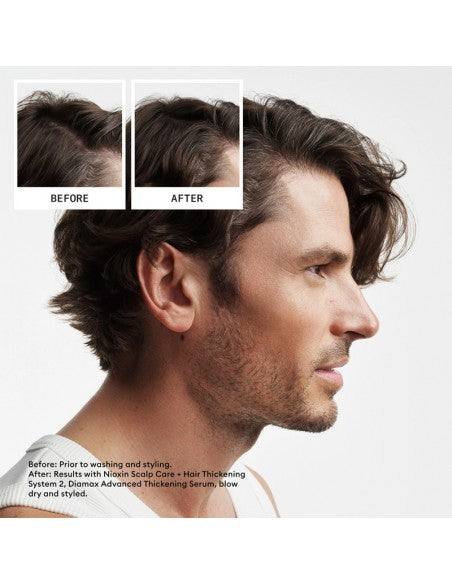 Nioxin - System 2 Kit