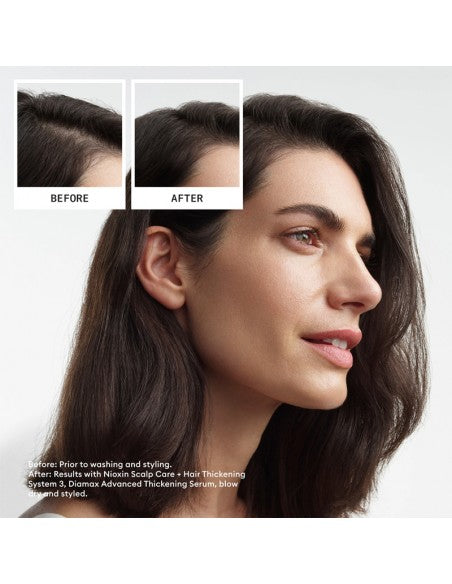 Nioxin - System 3 Kit