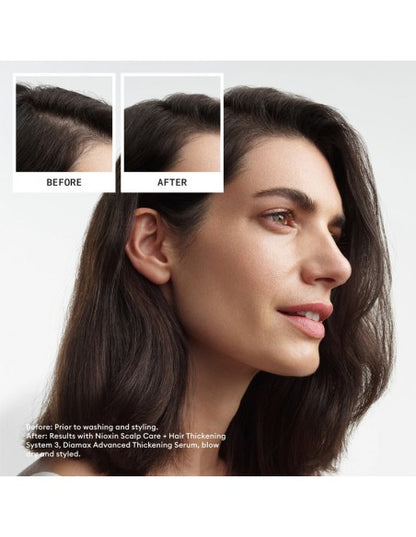 Nioxin - System 3 Kit