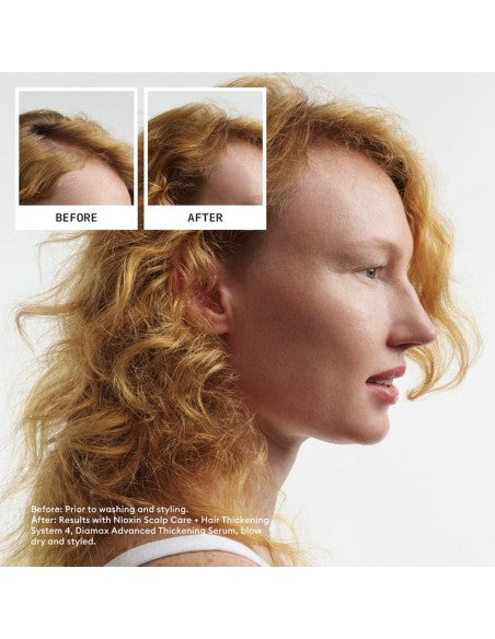 Nioxin - System 4 Kit