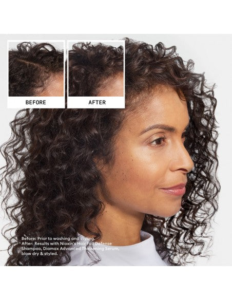 Nioxin - Ultimate Power - Hair Fall Defense Shampoo - 1000ml