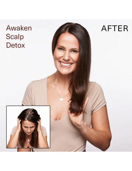 Surface - Awaken Scalp Detox - 177ml
