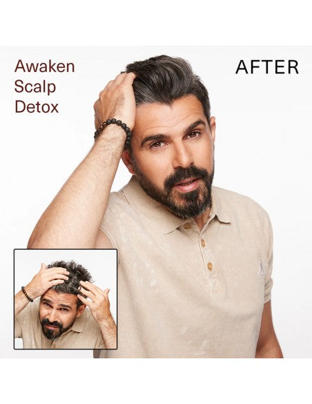 Surface - Awaken Scalp Detox - 177ml