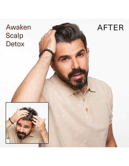 Surface - Awaken Scalp Detox - 177ml